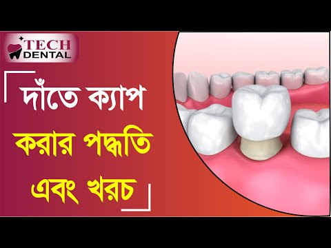 ভিডিও: কীভাবে মাড়ির বুদবুদ সঠিকভাবে ফুঁকবেন?