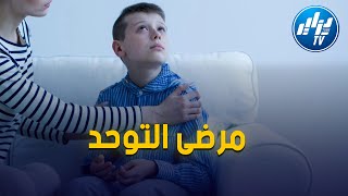 باتنة    أولياء أطفال التوحد يناشدون السلطات الولائية للرعاية الصحية لابناءهم