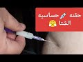 حقنه عضل هتجيب من الاخر في الشتا دة An Intramuscular Injection Will Do The Trick This Winter 
