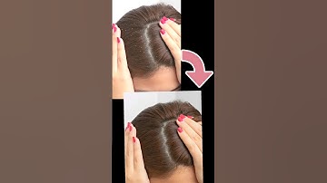 Remove Dandruff in Photoshop! Quick & Easy Tutorial