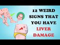 Warning 12 weird signs that show youre having liver damage