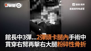 館長中3彈...2彈頭卡腿內手術中 貫穿右臂再擊右大腿粉碎性骨折
