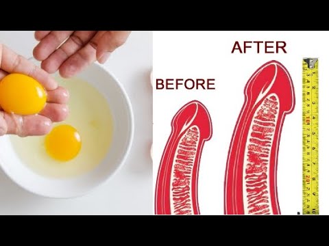 Benefits of chicken egg with honey  and lemon for health | How to be king | Only 3 Ingredients go 40