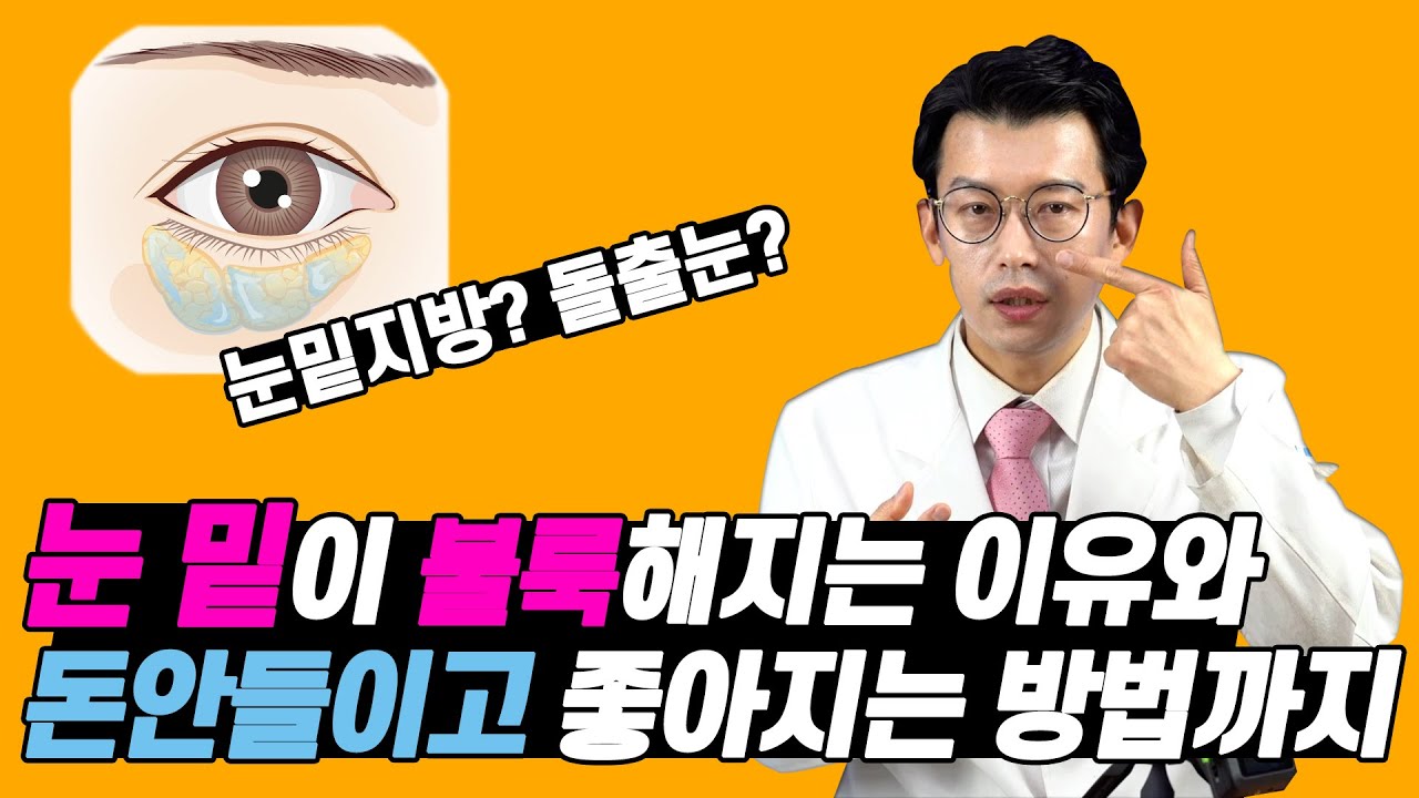 Why are my under-eyes fat? How to Remove Eye bags 눈밑이 불룩해지는 이유와 돈안들이고 좋아지는 방법까지!- 눈밑지방? 돌출눈?