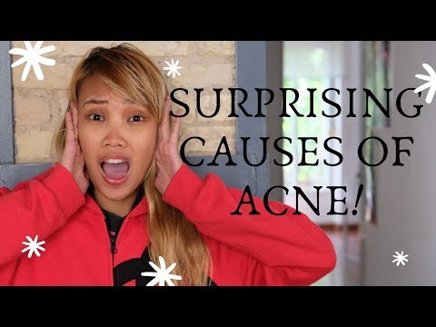  SURPRISING CAUSES OF ACNE