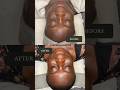 I deserve! #glowingskin #facials #skincare #blackskincare