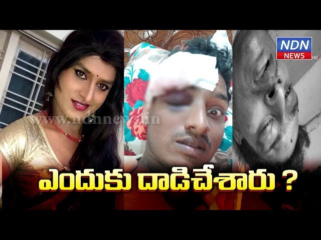 House Owner Attacks Jabardasth Vinod-Today Telugu Crime News-July 20 2019