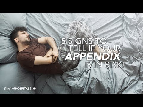Video: Poți simți când îți sparge apendicele?