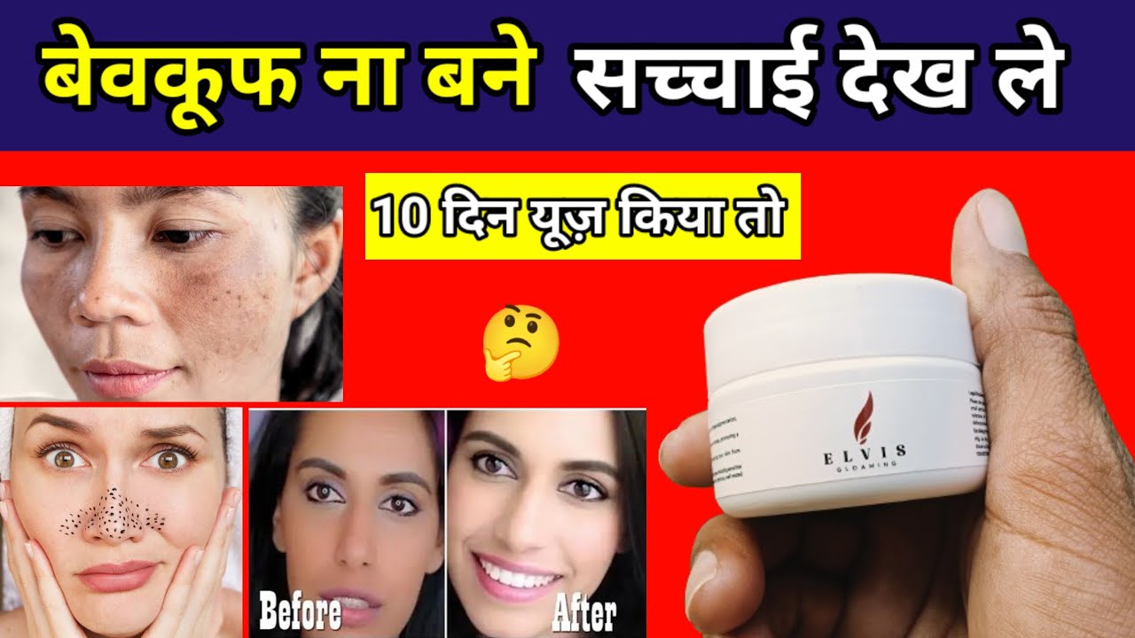 elvis skin whitening cream,elvis skin whitening cream review,best fairness cream 