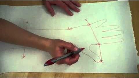 forearm based wrist cock up splint part 1