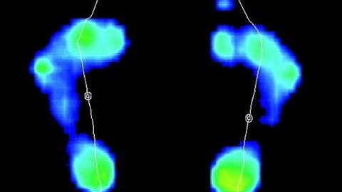 Gait Scan 2D