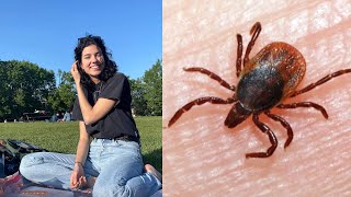 Quebec woman warning others about Lyme disease after late diagnosis | Tick safety