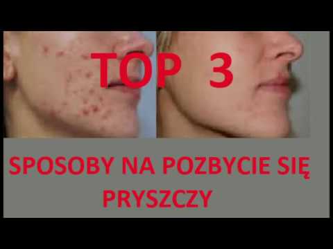 Wideo: 4 sposoby, aby guma utknęła we włosach