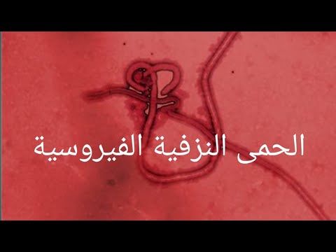 الحمى النزفية الفيروسية 😷