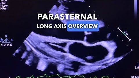 Parasternal Long Axis View - Echocardiography Education