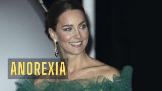 ROYAL FAMILY NEWS! Excessive thinness of Princess Catherine worries fans Information