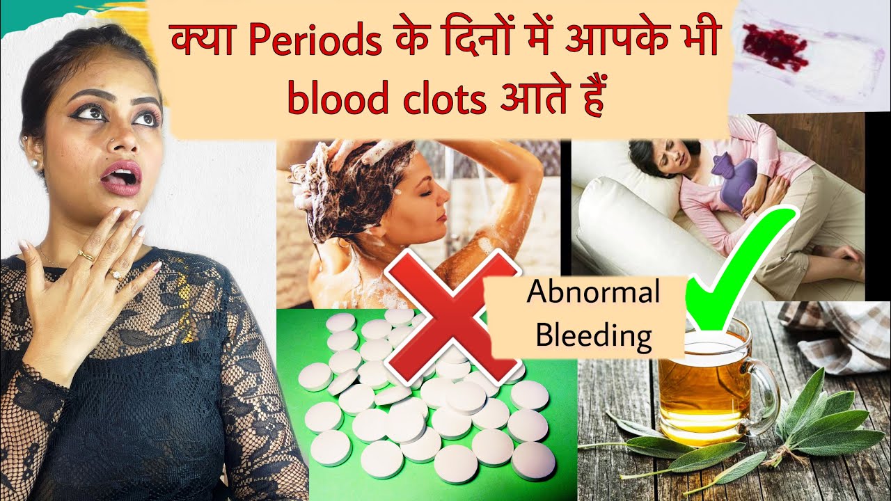Irregular periodsperiod pain ko ghar me kaise thik karehome remedy