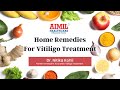 Effective Home Remedies to Treat Safed Daag/Vitiligo | Dr. Nitika Kohli