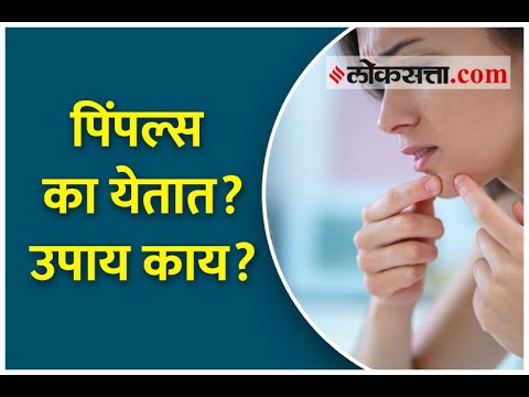 पिंपल्स का येतात?, आणि त्या वर उपाय काय. | Why do pimples appear ?, and what are the remedies.