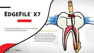 EdgeFile® X7 - system pilników maszynowych