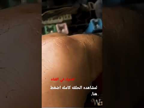 حل سريع لعطل محرك هيونداي ماتريكس