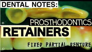RETAINERS II CLASSIFICATION AND CRITERIA FOR SELECTION II FIXED PARTIAL DENTURE II PROSTHODONTICS