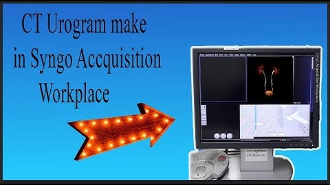 ct urogram post processing