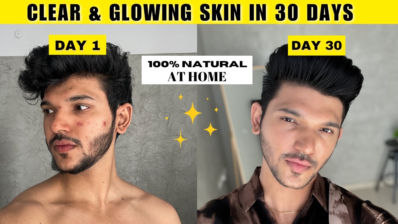 GOT CLEAR & GLOWING SKIN IN JUST 30 DAYS NATURALLY | HOW TO GET CLEAR ...