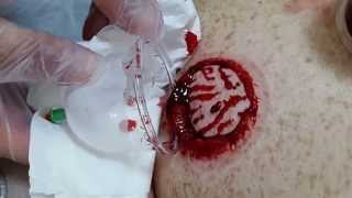 Download Kafadan Kan Değil Resmen Simsiyah Çamur Ve Ağır Metal Çıkıyor Video MP3 Kafadan Kan Değil Resmen Simsiyah Çamur Ve Ağır Metal Çıkıyor