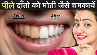Teeth Whitening At Home : पीले दांतों को सफ़ेद करने का सबसे असरदार तरीका | Oral Hygiene Routine 💕 screenshot 2