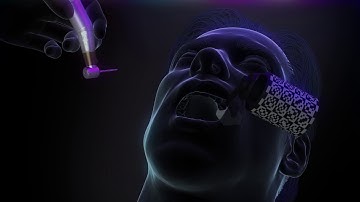 X-Guide™, the navigation system that’s like a GPS for your drill