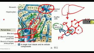 PATHOLOGY | Liver | CIRRHOSIS , alcoholic liver disease