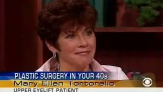 Eyelid Lift - CBS Early Show Upper Eyelid Surgery