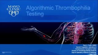 Algorithmic Thrombophilia Testing