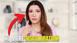 The Color Correction You Didn't Know You Needed!
