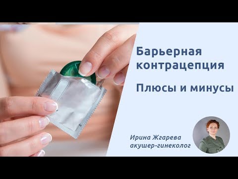 Барьерная контрацепция как метод контрацепции. Плюсы и минусы барьерной контрацепции