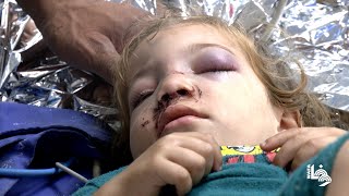 الاطفال أكثر جرحى قصف طائرات الاحتلال في غزة