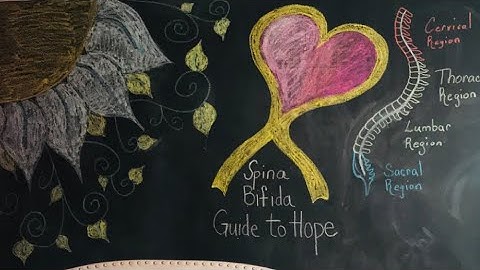 Five Years Of Pain: My Tethered Cord