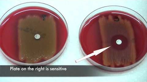 Bacitracin test for Streptococcus pyogenes