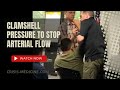 Clamshell pressure to stop arterial flow