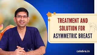 What are Asymmetric Breasts? Complete Guide to Their Treatments and Solutions!