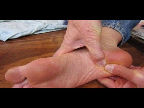 أسباب حكة باطن القدم