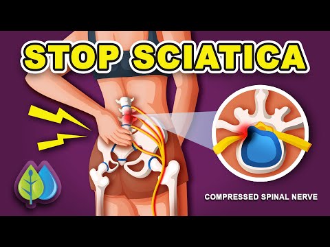 How To Stop Sciatica Pain &amp; Relieve Nerve Pain | Fast Sciatica Relief