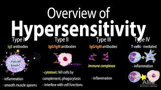Hypersensitivity, Overview of the 4 Types, Animation. screenshot 2