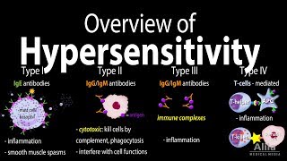 Hypersensitivity, Overview of the 4 Types, Animation.