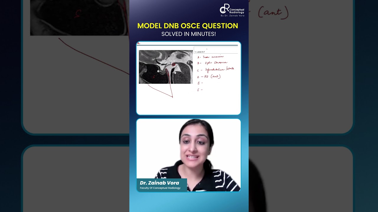 Model DNB OSCE Case Discussion | Dr. Zainab Vora | Conceptual Radiology 