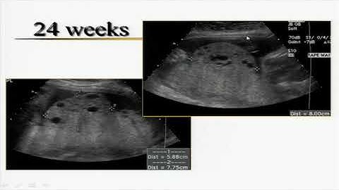 Obstetrics case studies