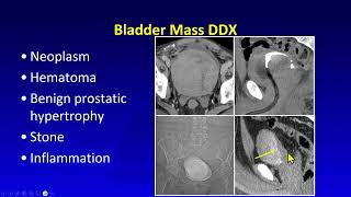 080 CT and MRI Imaging of the Bladder Medstudylab.com