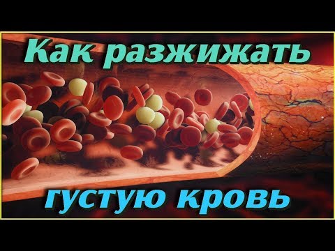 Как РАЗЖИЖАТЬ густую кровь БЕЗ ЛЕКАРСТВ в домашних условиях. Самые эффективные ОТВАРЫ И НАПИТКИ
