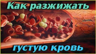 Как Разжижать Густую Кровь Без Лекарств В Домашних Условиях. Самые Эффективные Отвары И Напитки